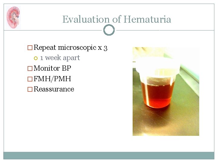 Evaluation of Hematuria � Repeat microscopic x 3 1 week apart � Monitor BP