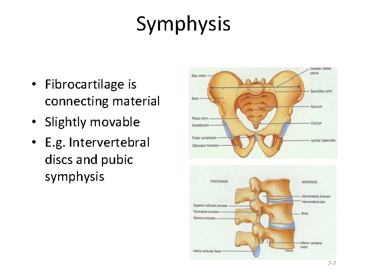 Symphysis • Fibrocartilage is connecting material • Slightly movable • E. g. Intervertebral discs