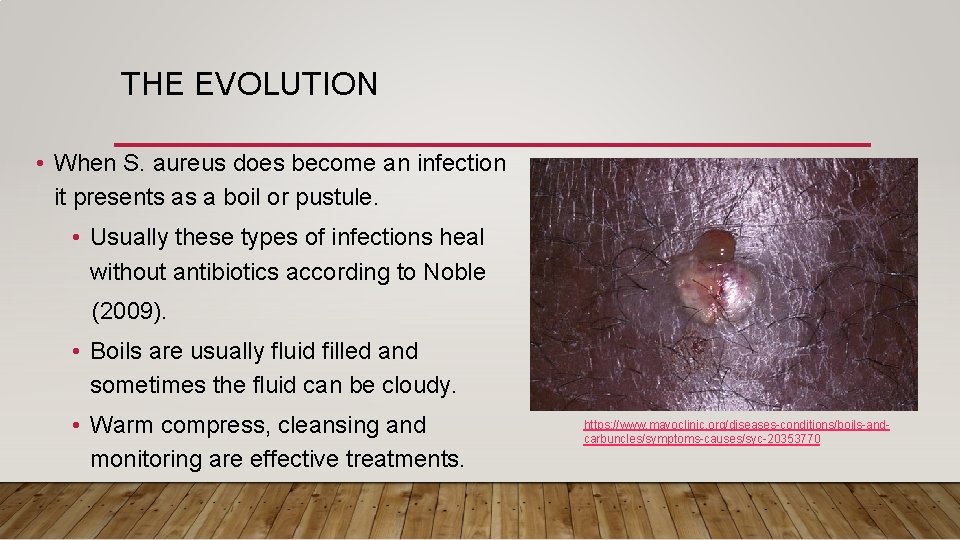 THE EVOLUTION • When S. aureus does become an infection it presents as a