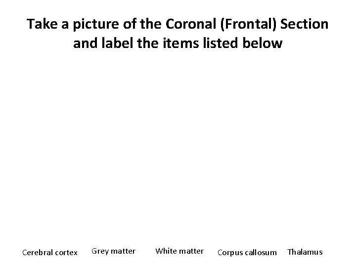 Take a picture of the Coronal (Frontal) Section and label the items listed below