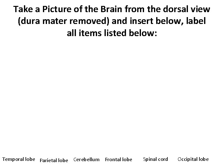 Take a Picture of the Brain from the dorsal view (dura mater removed) and