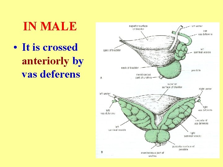 IN MALE • It is crossed anteriorly by vas deferens 