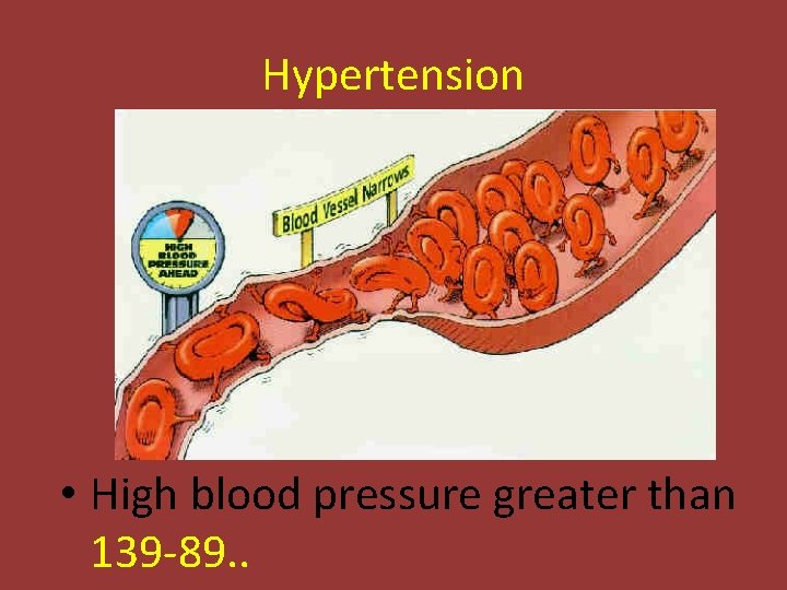 Hypertension • High blood pressure greater than 139 -89. . 