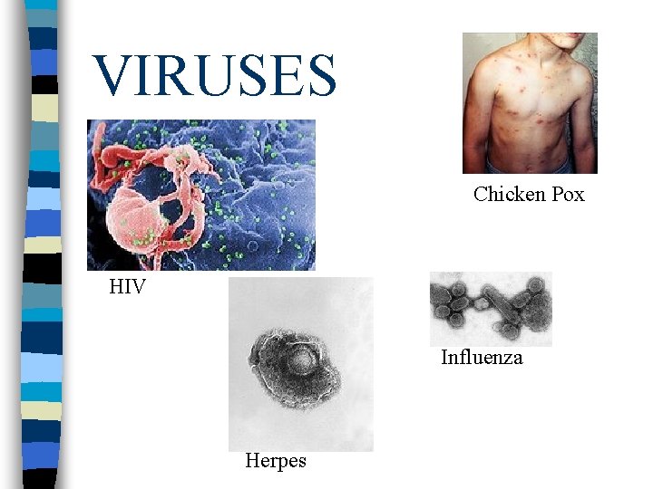 VIRUSES Chicken Pox HIV Influenza Herpes 