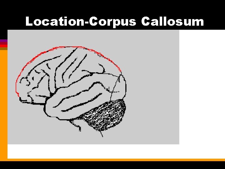 Location-Corpus Callosum 