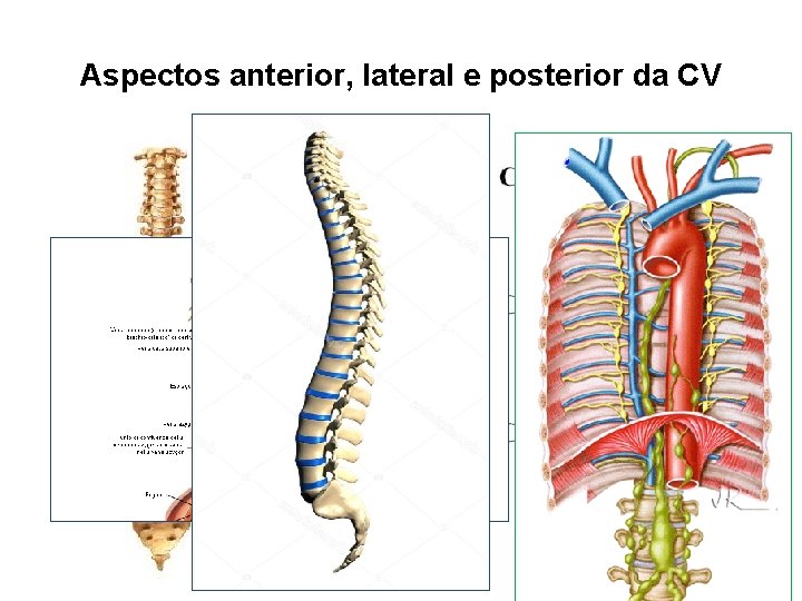 Aspectos anterior, lateral e posterior da CV 