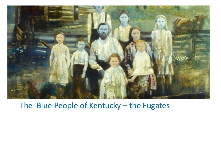 The Blue People of Kentucky – the Fugates Methemoglobinemia 