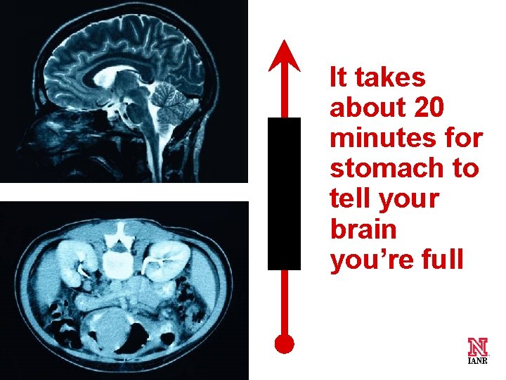 20 minutes 11 It takes about 20 minutes for stomach to tell your brain