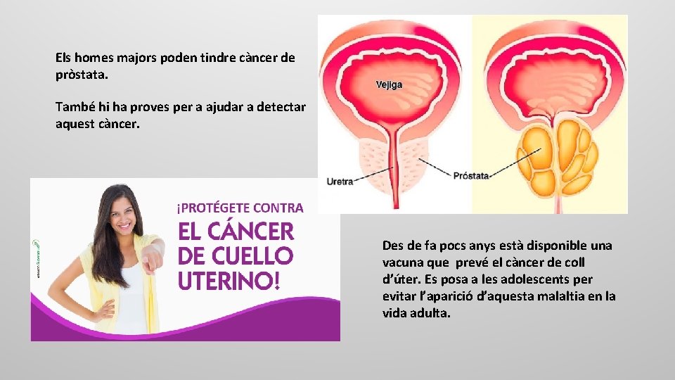Els homes majors poden tindre càncer de pròstata. També hi ha proves per a