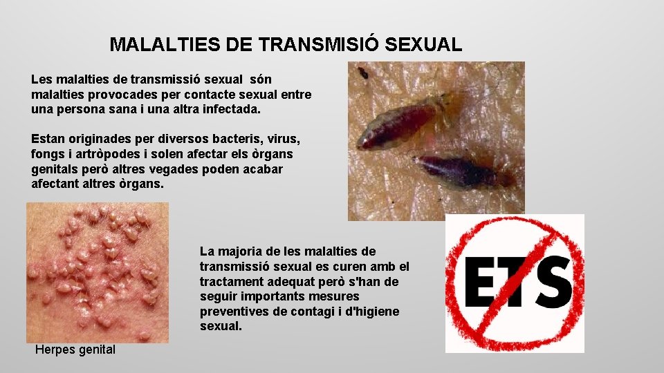 MALALTIES DE TRANSMISIÓ SEXUAL Les malalties de transmissió sexual són malalties provocades per contacte