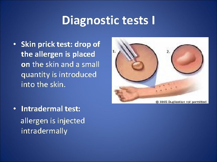 Diagnostic tests I • Skin prick test: drop of the allergen is placed on