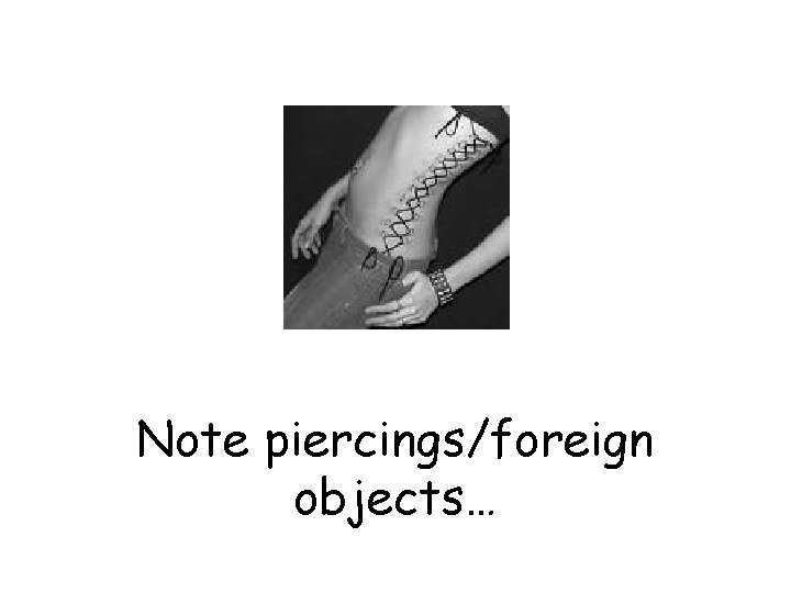 Note piercings/foreign objects… 