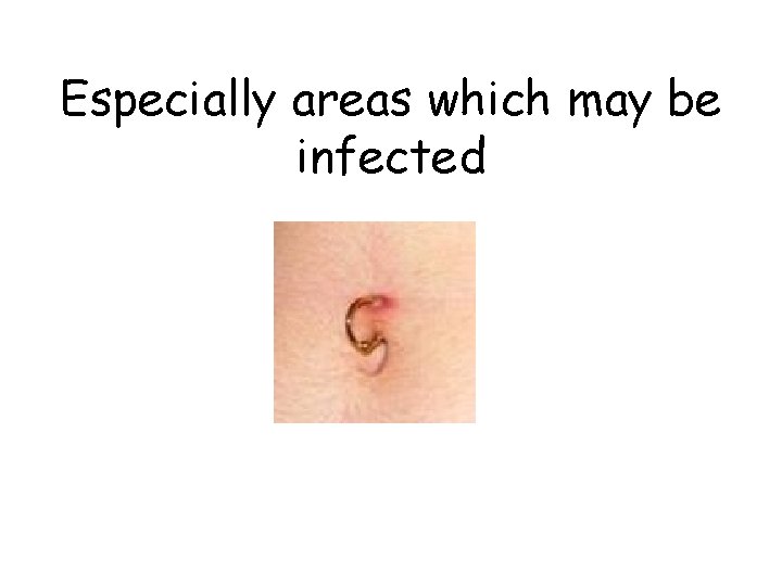 Especially areas which may be infected 