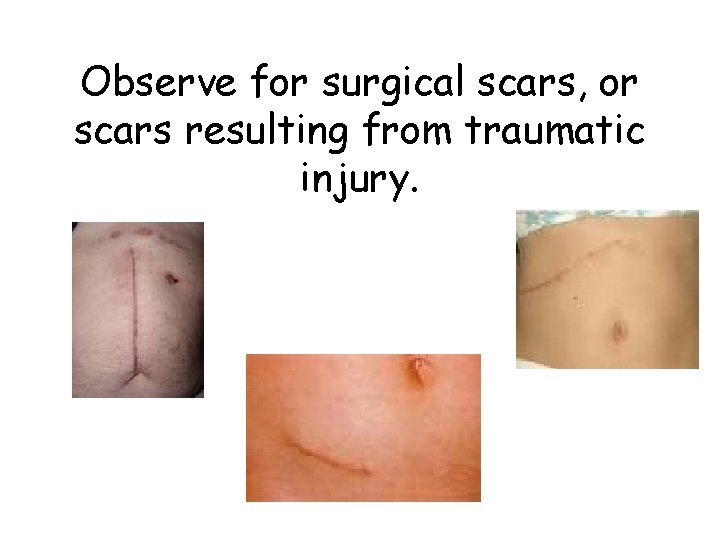Observe for surgical scars, or scars resulting from traumatic injury. 