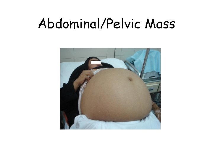 Abdominal/Pelvic Mass 