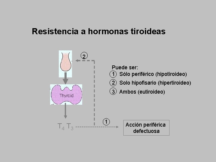 Resistencia a hormonas tiroideas 2 Puede ser: 1 Sólo periférico (hipotiroideo) 2 Solo hipofisario