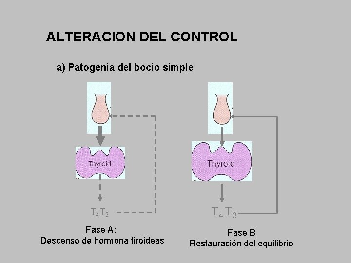 ALTERACION DEL CONTROL a) Patogenia del bocio simple T 4 T 3 Fase A: