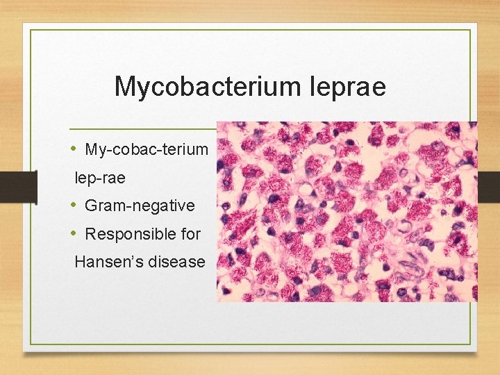 Mycobacterium leprae • My-cobac-terium lep-rae • Gram-negative • Responsible for Hansen’s disease 
