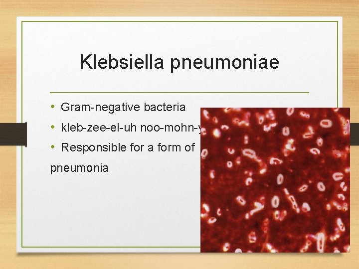 Klebsiella pneumoniae • Gram-negative bacteria • kleb-zee-el-uh noo-mohn-yuh • Responsible for a form of