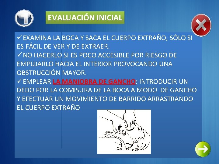 EVALUACIÓN INICIAL üEXAMINA LA BOCA Y SACA EL CUERPO EXTRAÑO, SÓLO SI ES FÁCIL