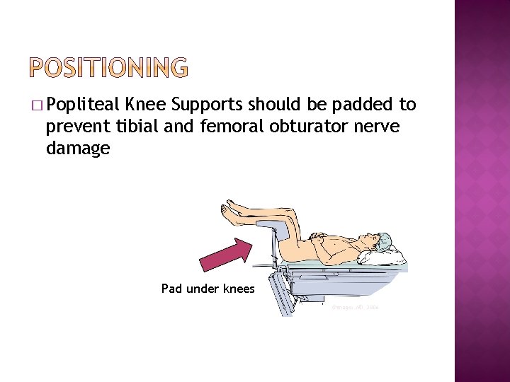 � Popliteal Knee Supports should be padded to prevent tibial and femoral obturator nerve