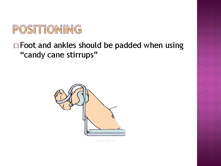 � Foot and ankles should be padded when using “candy cane stirrups” ©images. MD,