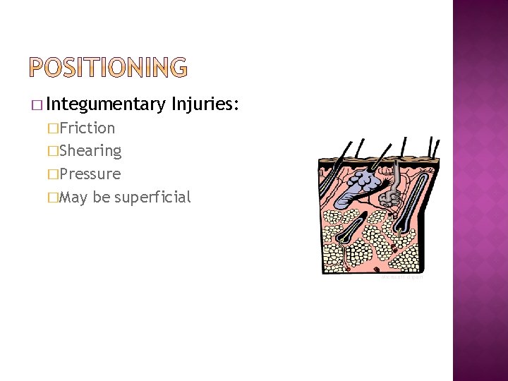 � Integumentary Injuries: �Friction �Shearing �Pressure �May be superficial Microsoft clipart 