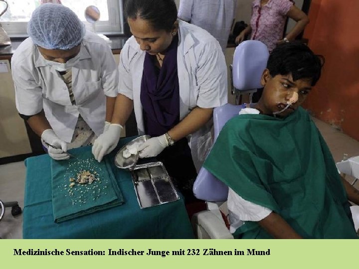 Medizinische Sensation: Indischer Junge mit 232 Zähnen im Mund 