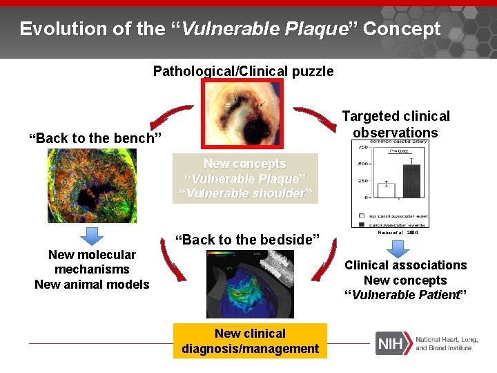 Evolution of the “Vulnerable Plaque” Concept Pathological/Clinical puzzle Targeted clinical observations “Back to the