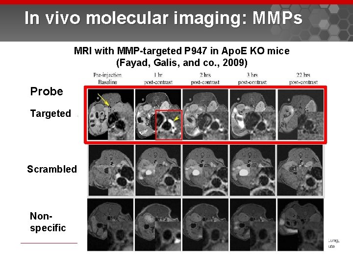 In vivo molecular imaging: MMPs MRI with MMP-targeted P 947 in Apo. E KO