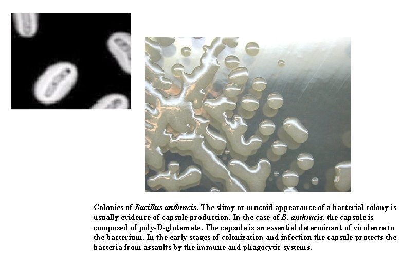 Colonies of Bacillus anthracis. The slimy or mucoid appearance of a bacterial colony is