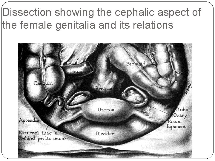 Dissection showing the cephalic aspect of the female genitalia and its relations 