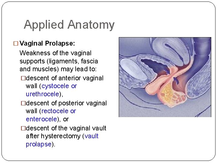 Applied Anatomy � Vaginal Prolapse: Weakness of the vaginal supports (ligaments, fascia and muscles)