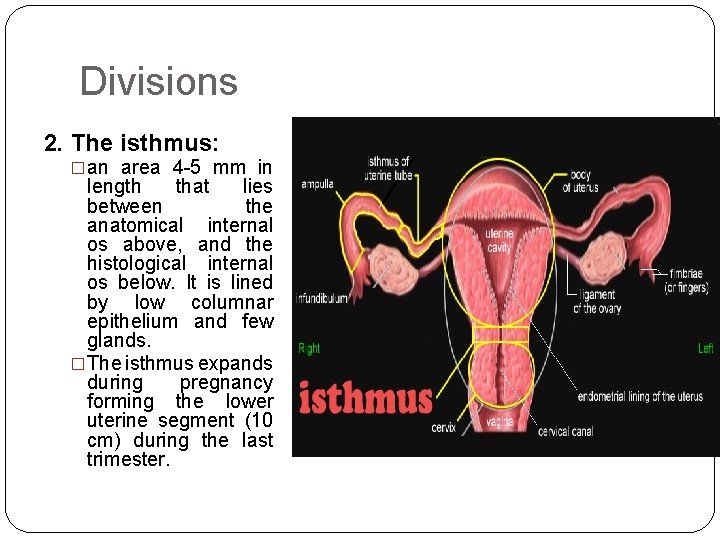 Divisions 2. The isthmus: �an area 4 -5 mm in length that lies between
