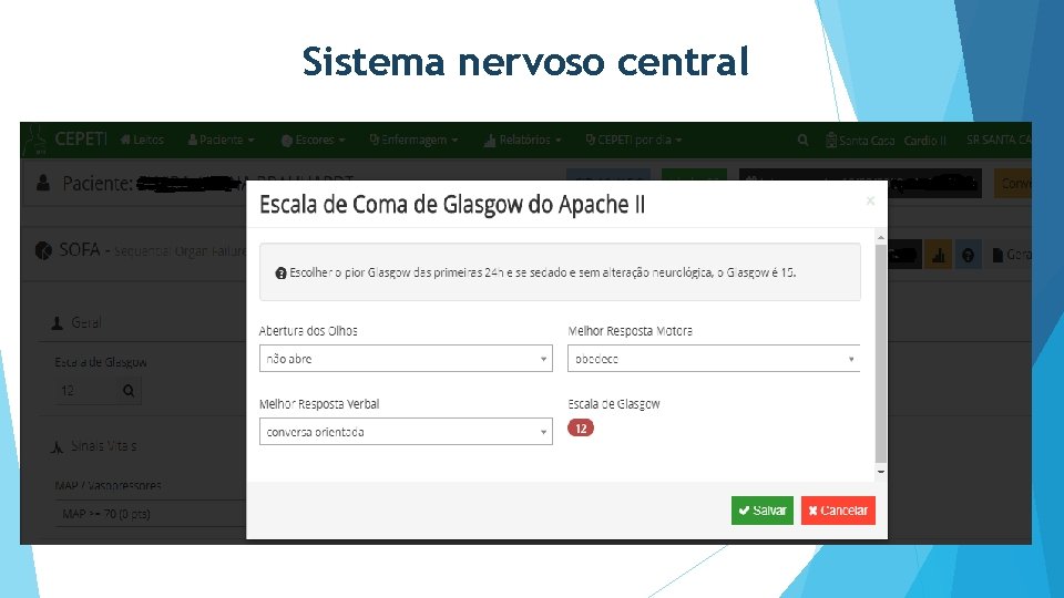 Sistema nervoso central 