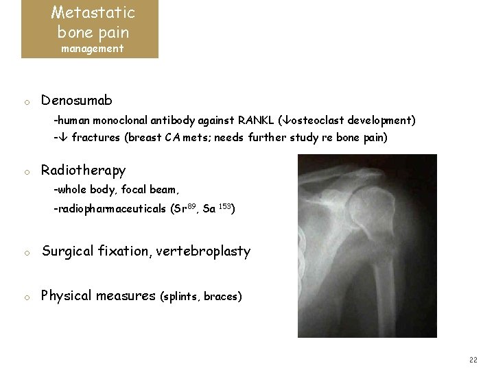 Metastatic bone pain management o Denosumab -human monoclonal antibody against RANKL ( osteoclast development)