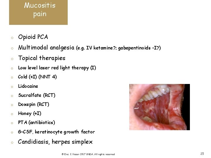 Mucositis pain o Opioid PCA o Multimodal analgesia o Topical therapies o Low level