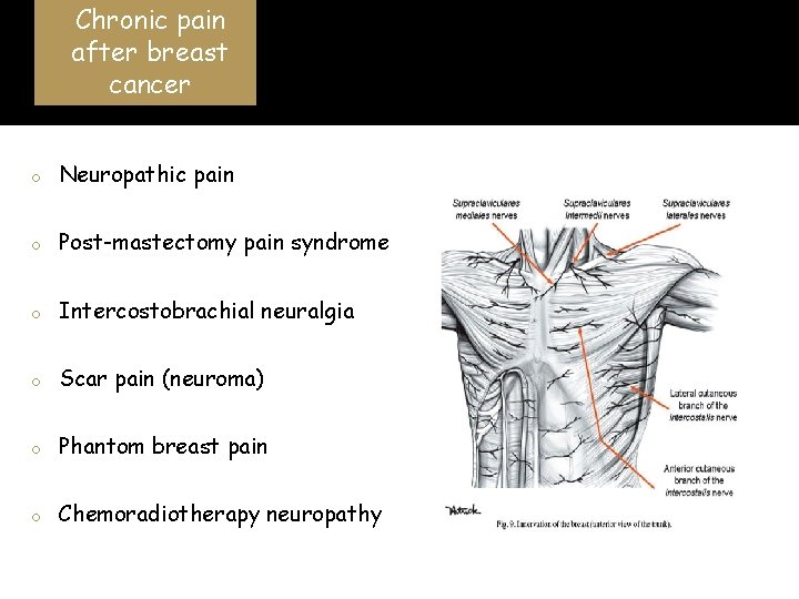 Chronic pain after breast cancer o Neuropathic pain o Post-mastectomy pain syndrome o Intercostobrachial