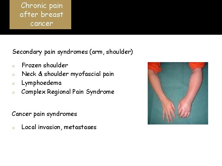 Chronic pain after breast cancer Secondary pain syndromes (arm, shoulder) o o Frozen shoulder