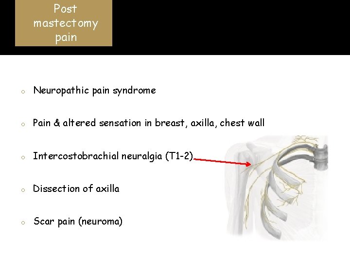 Post mastectomy pain Jung BF et al. Pain 2003 o Neuropathic pain syndrome o