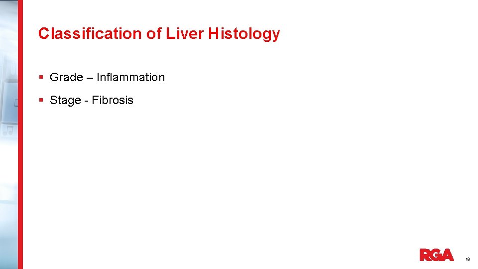 Classification of Liver Histology § Grade – Inflammation § Stage - Fibrosis 18 