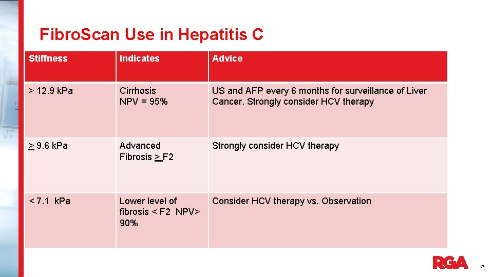 Fibro. Scan Use in Hepatitis C Stiffness Indicates Advice > 12. 9 k. Pa