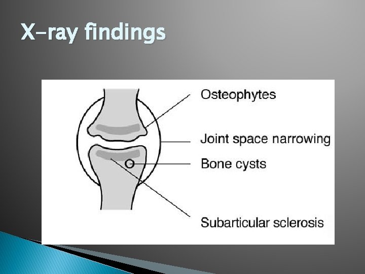 X-ray findings 