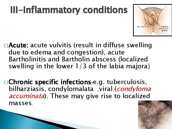 III-Inflammatory conditions � Acute: acute vulvitis (result in diffuse swelling due to edema and