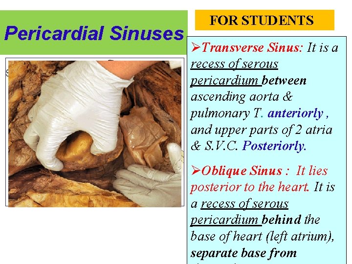 Pericardial Sinuses FOR STUDENTS ØTransverse Sinus: It is a recess of serous pericardium between