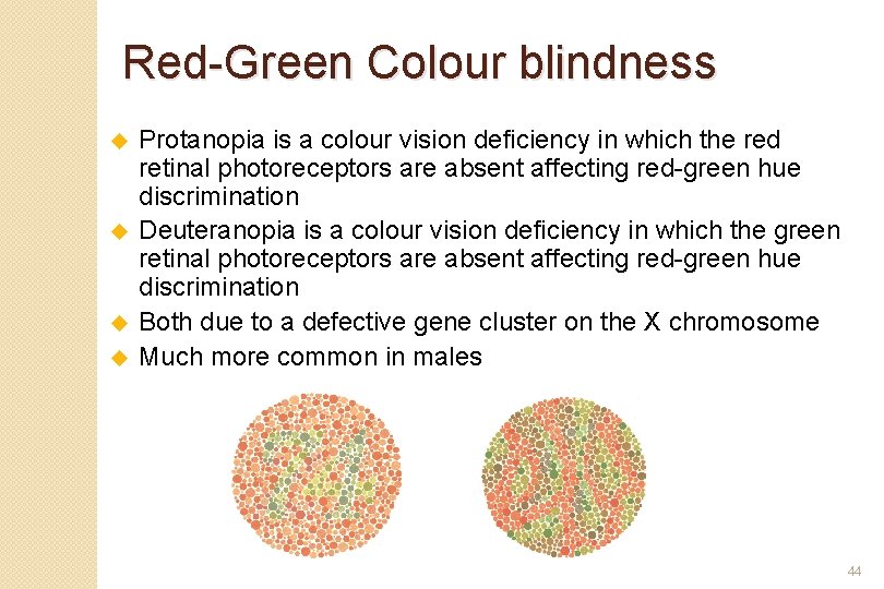 Red-Green Colour blindness u u Protanopia is a colour vision deficiency in which the