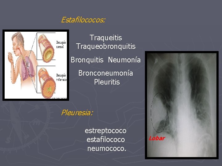 Estafilococos: Traqueitis Traqueobronquitis Bronquitis Neumonía Bronconeumonía Pleuritis Pleuresia: estreptococo estafilococo neumococo. Lobar 