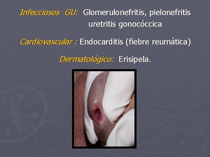 Infecciosos GU: Glomerulonefritis, pielonefritis uretritis gonocóccica Cardiovascular : Endocarditis (fiebre reumática) Dermatológico: Erisipela. 