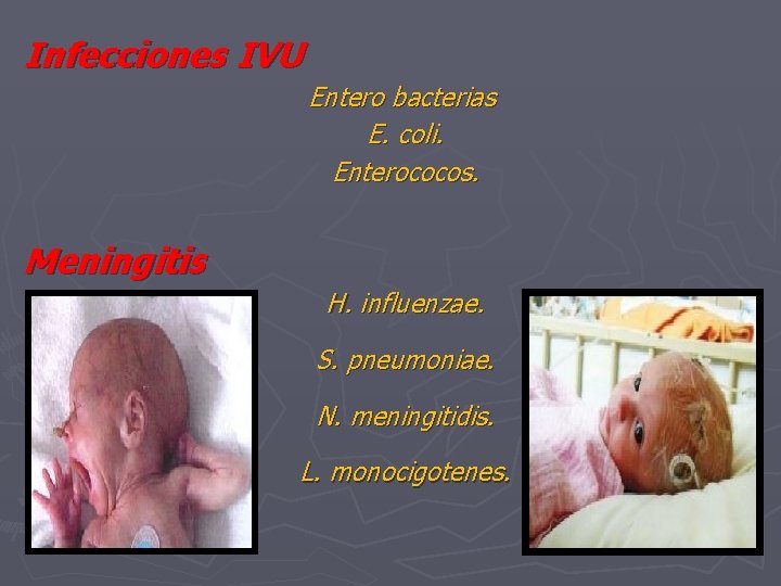Infecciones IVU Entero bacterias E. coli. Enterococos. Meningitis H. influenzae. S. pneumoniae. N. meningitidis.