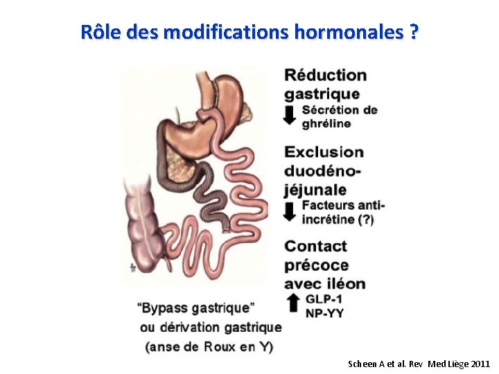 Rôle des modifications hormonales ? Scheen A et al. Rev Med Liège 2011 